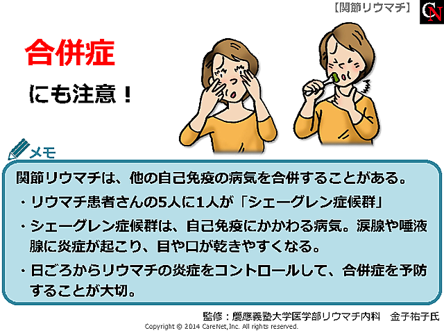 合併症の予防が大切のイメージ