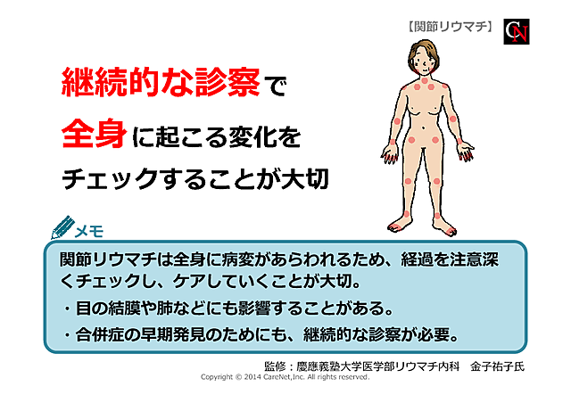 継続的な診察が必要のイメージ