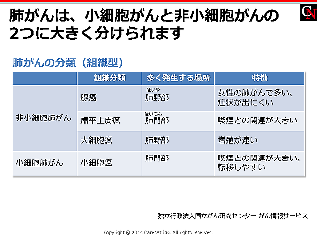 肺がんの組織型の説明にのイメージ