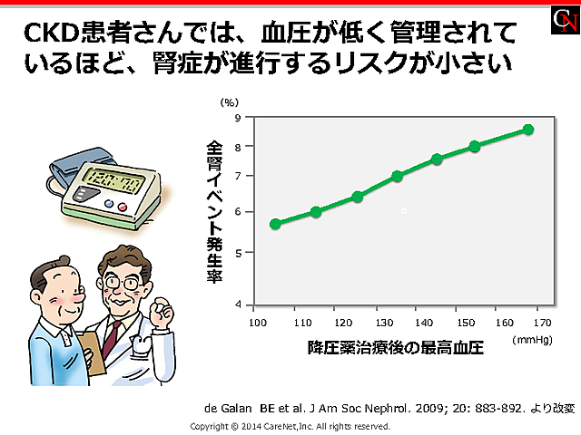 血圧と腎症進行リスクの関係のイメージ