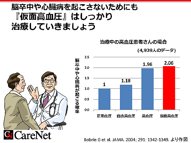 仮面高血圧のイベントリスクのイメージ