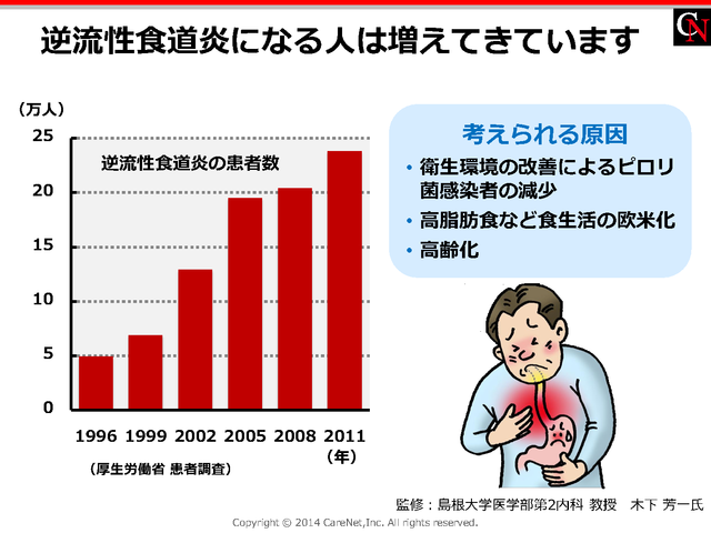 逆流性食道炎患者の増加のイメージ