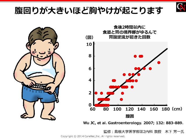 腹回りと胸やけのイメージ