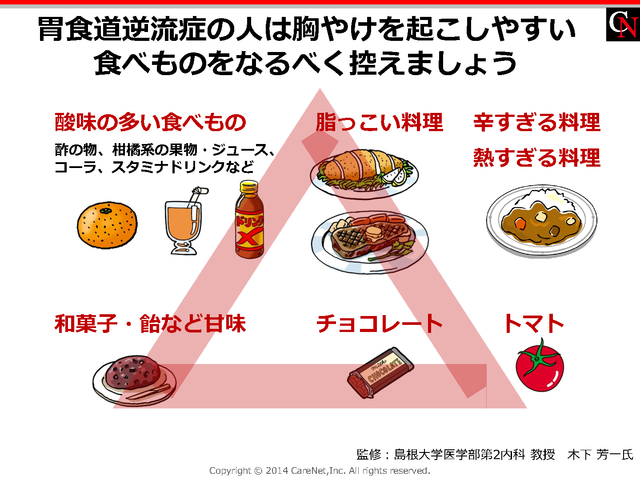 胃食道逆流症で控える食品のイメージ