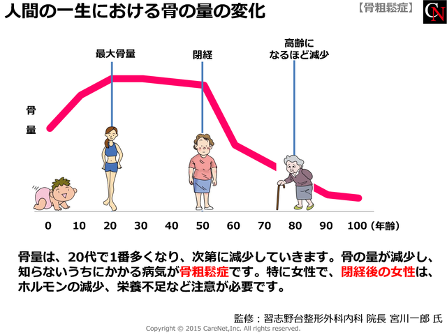 骨の強さは何でわかる？のイメージ