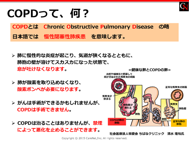 COPDって、何？のイメージ