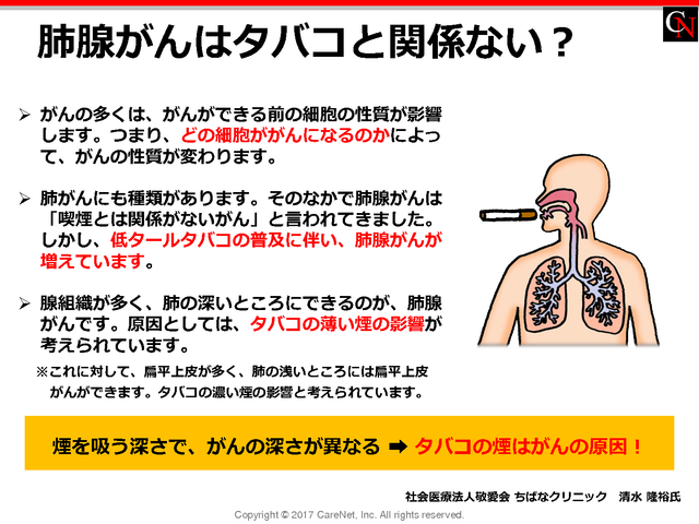 肺腺がんはタバコとは関係ない？のイメージ