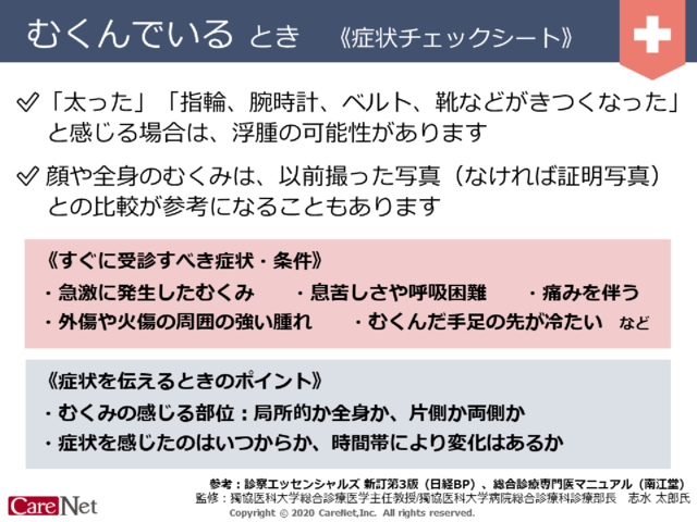 むくんでいるときの症状チェックのイメージ