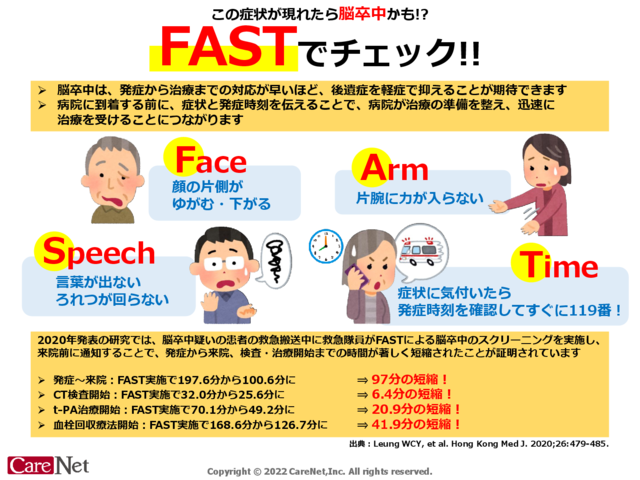 脳卒中の症状はFASTでチェックのイメージ