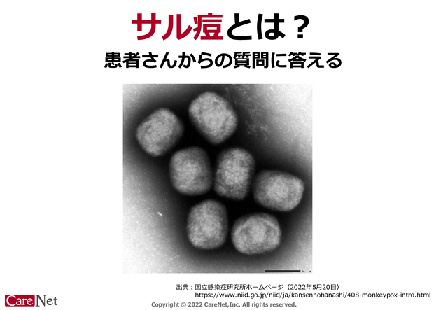 サル痘とは？のイメージ