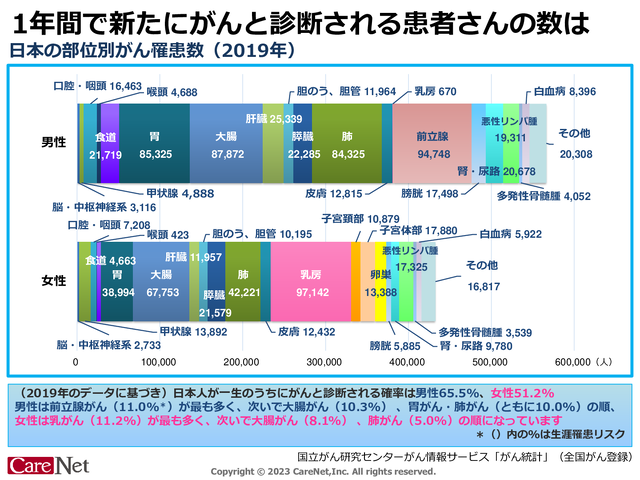 日本の部位別がん罹患数のイメージ