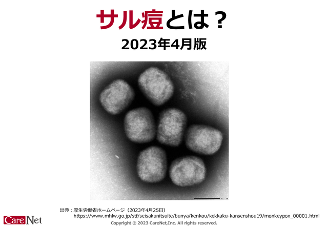 サル痘とは？（2023年4月更新版）のイメージ
