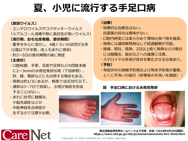 手足口病の予防は手洗いでのイメージ