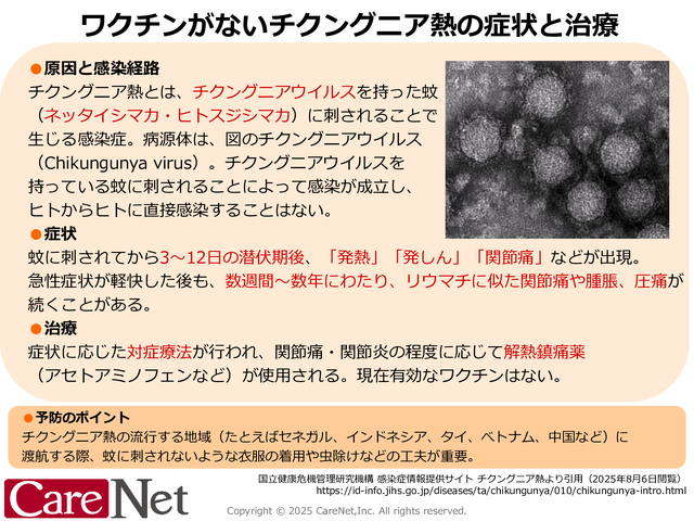 ワクチンがないチクングニア熱の診療のイメージ