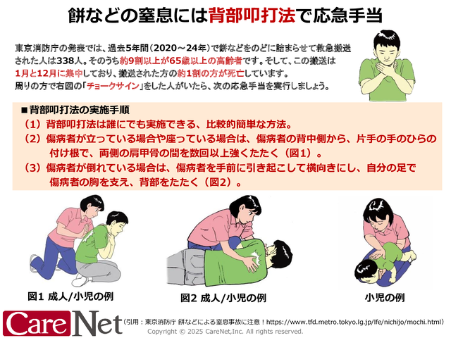 餅などの窒息時に有用な背部叩打法を説明