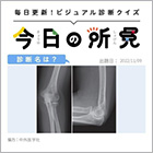 診断名は？【1日1症例のビジュアル診断クイズ】