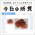 診断名は？【1日1症例のビジュアル診断クイズ】
