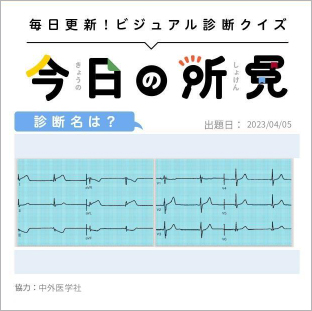 診断名は？【1日1症例のビジュアル診断クイズ】