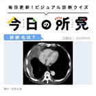 診断名は？【1日1症例のビジュアル診断クイズ】