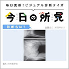 診断名は？【1日1症例のビジュアル診断クイズ】