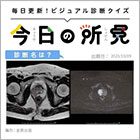 診断名は？【1日1症例のビジュアル診断クイズ】