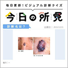 診断名は？【1日1症例のビジュアル診断クイズ】