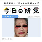 80代・女性。食欲低下と顔面～四肢に紅色皮疹。診断は？