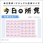 80代・男性。昼食中に胸が苦しくなり、冷汗が出て眼前暗黒感も認める。診断は？