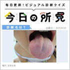 5歳・女児。舌を出すと右に曲がっていた。診断は？