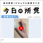 【動画】息切れがあり、BNP値が上昇している症例。診断は？