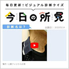 【動画】労作時の息切れを訴える症例（座位）。診断は？