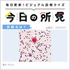 60代・男性。発熱と後頭部痛。診断は？