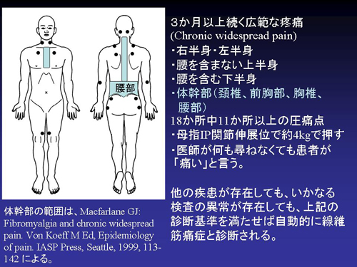 痛 線維 症 筋 線維筋痛症｜公益財団法人日本リウマチ財団