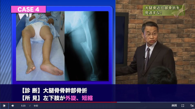 11月の無料公開 研修医向け臨床医学動画 研修医必見 すぐに役立つ医学動画ピックアップ 医師向け医療ニュースはケアネット